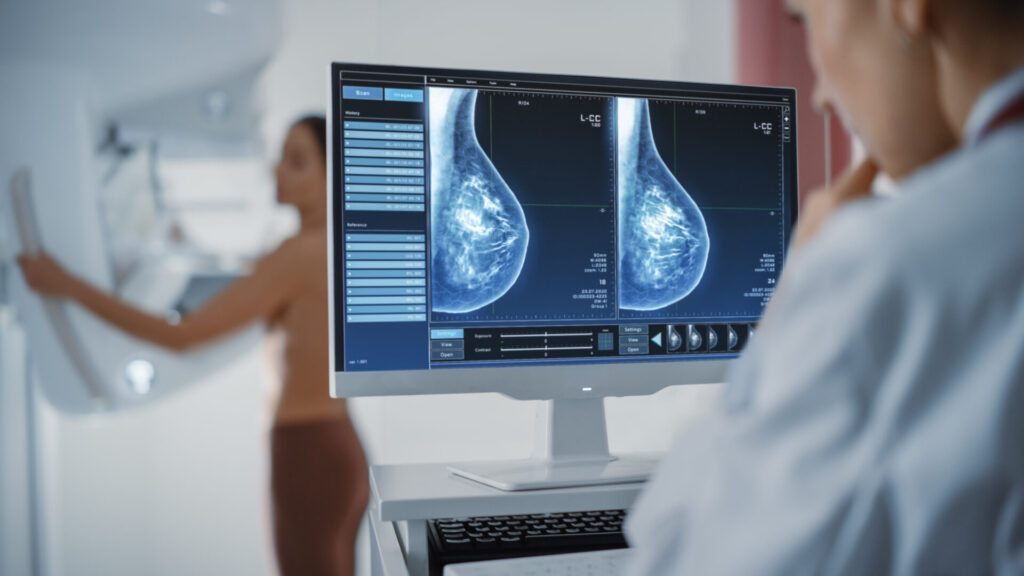 Breast Screening Program (OBSP)