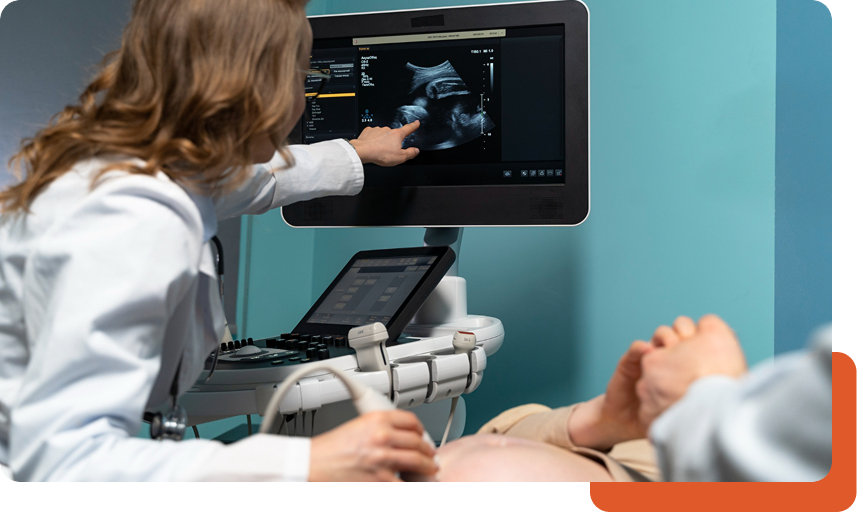 echocardiogram
