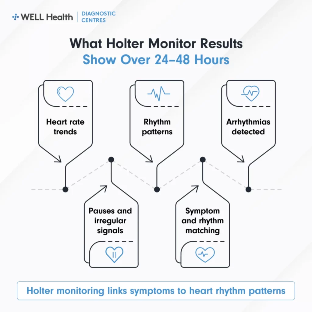 What Holter Monitor Results Show Over 24–48 Hours