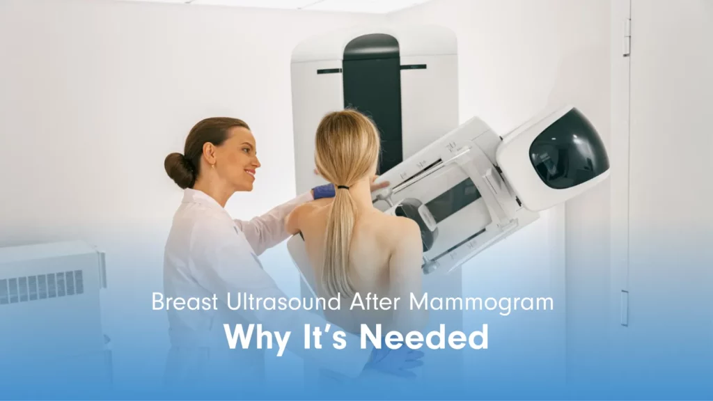 When a Breast Ultrasound Is Ordered After Mammography