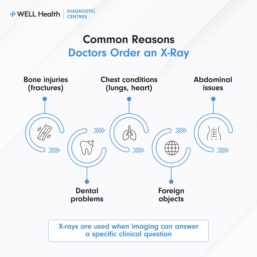 Common Reasons Doctors Order an X-Ray