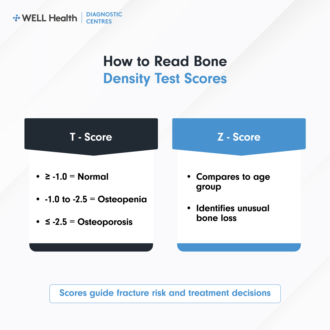 How to Read Bone Density Test Scores